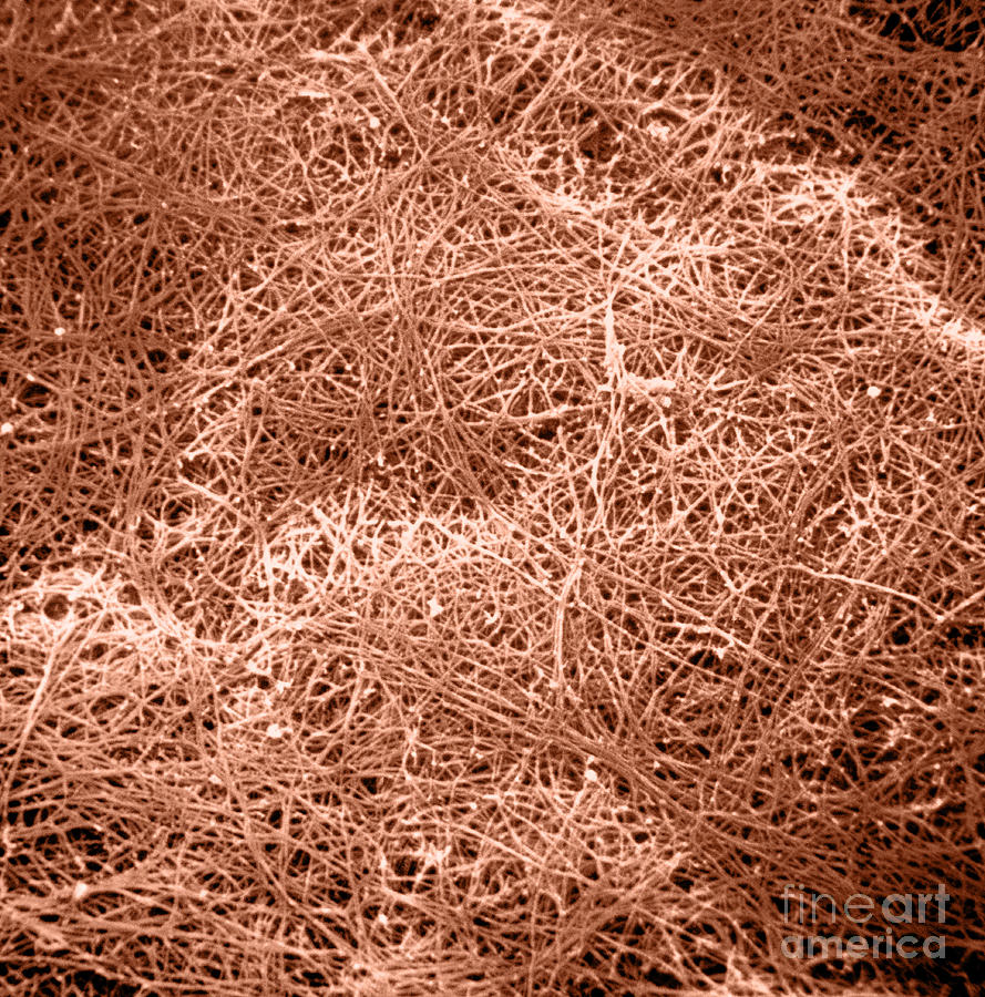 Sem Of Collagen #2 Photograph by David M. Phillips