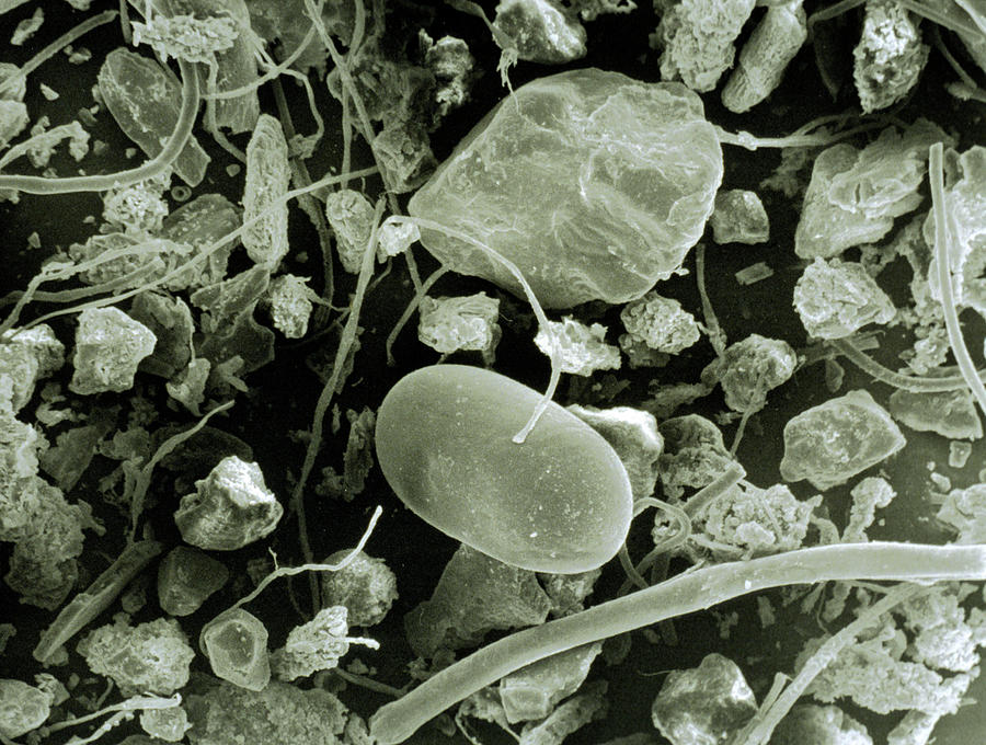 Sem Of Household Dust From Vacuum Cleaner #2 Photograph by Science Photo Library