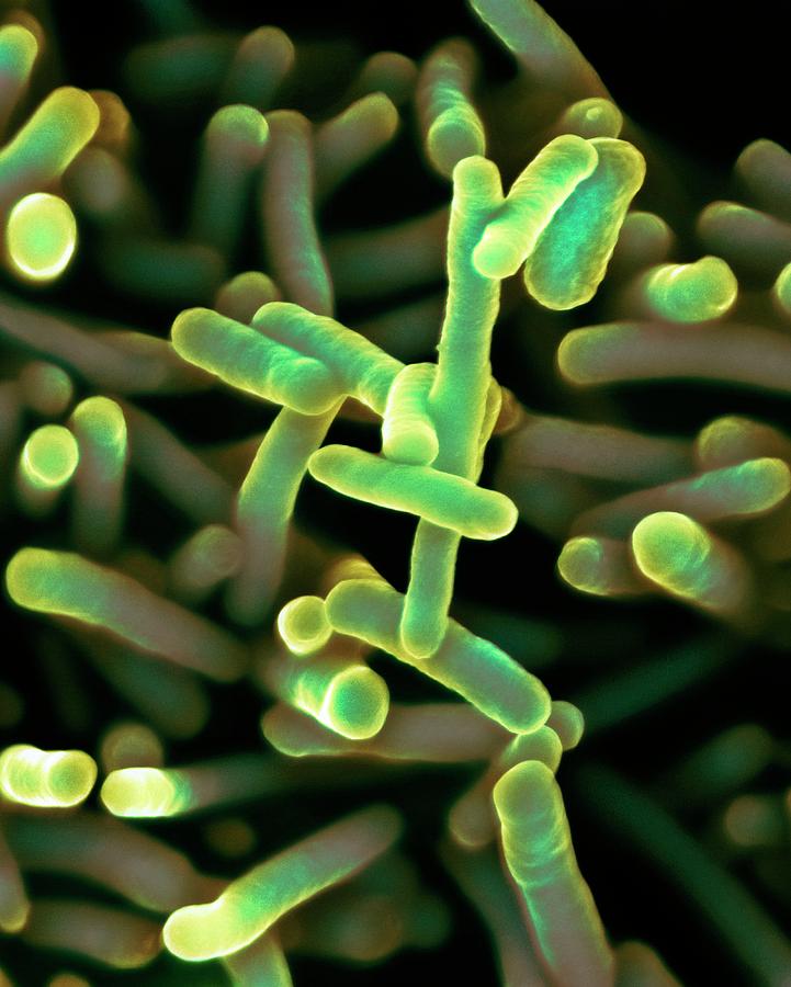 Bacillary Dysentery Photograph - Shigella Dysenteriae Bacteria #2 by Dennis Kunkel Microscopy/science Photo Library