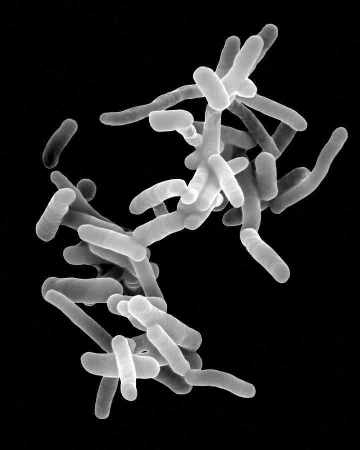 Shigella Dysenteriae #2 by Science Photo Library