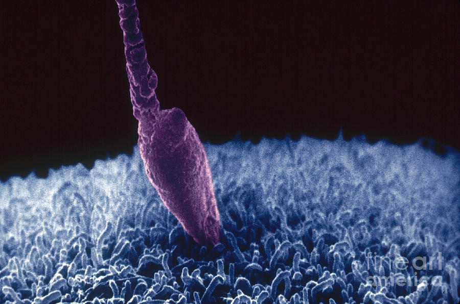Single Sperm Fertilizing An Egg, Sem #2 Photograph by David M. Phillips