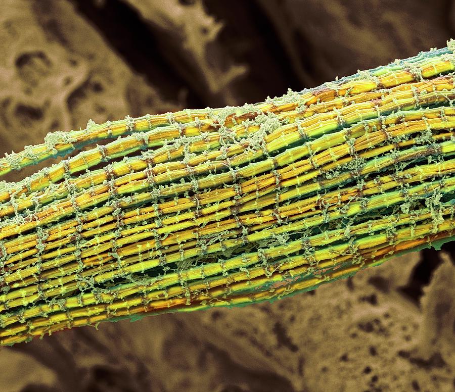 Skeletal Muscle Fibres #2 Photograph by Steve Gschmeissner