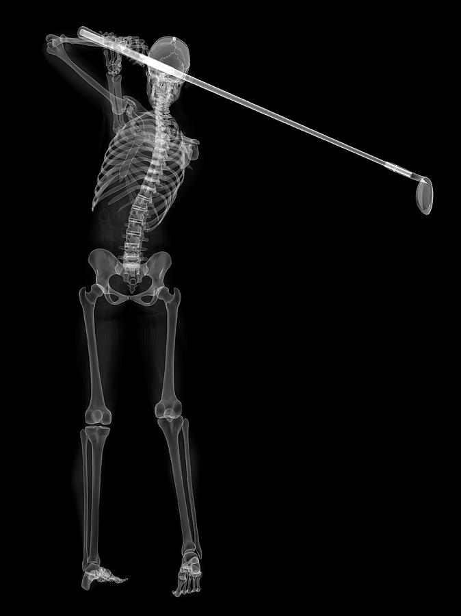 Skeleton Playing Golf #2 Photograph by Sciepro/science Photo Library