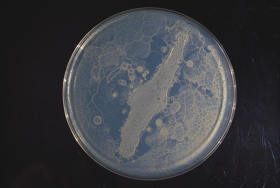 Slime Mold Plasmodium #2 Photograph by Biology Pics