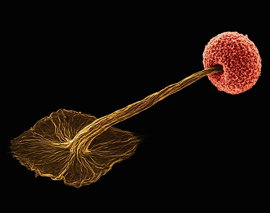 Slime Mould Sporocarp (didymium Sp.) #2 Photograph by Dennis Kunkel Microscopy/science Photo Library