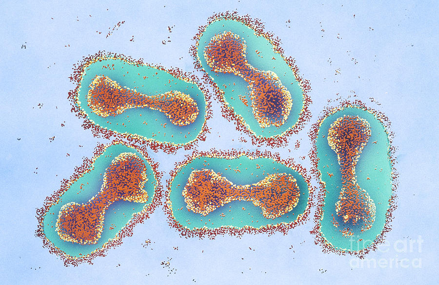Smallpox Virus #2 Photograph by Chris Bjornberg