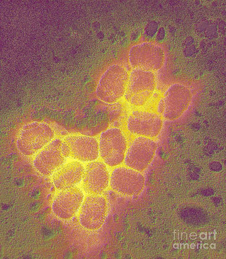 Smallpox Virus #2 Photograph by Scott Camazine