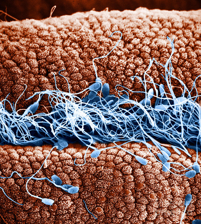 Sperm On Oviduct Surface, Sem #2 Photograph by David M. Phillips