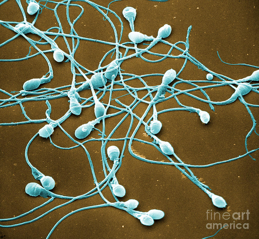 Sperm, Sem #2 Photograph by David M. Phillips