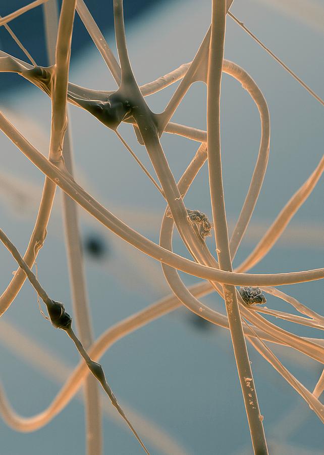 Spider's Silk Photograph by Stefan Diller/science Photo Library - Fine ...