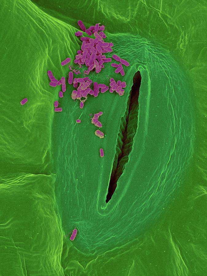 Spinach Infected With E. Coli #2 Photograph by Dennis Kunkel Microscopy/science Photo Library