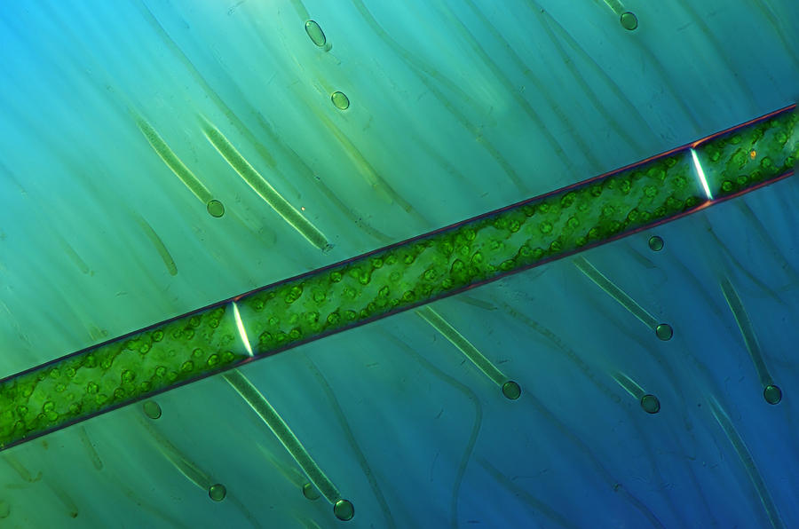 Spirogyra Sp. And Rivularia, Lm #2 Photograph by Marek Mis