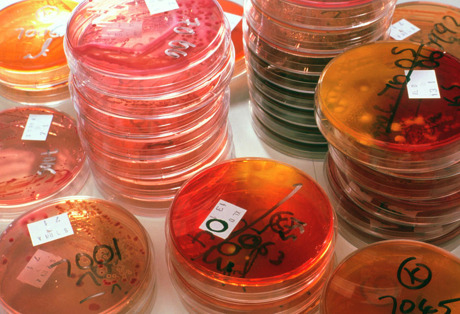 Stacks Of Petri Dish Faecal Bacterial Cultures #2 Photograph by Jim Varney/science Photo Library