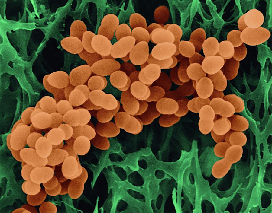 Staphylococcus Aureus #2 Photograph by Dennis Kunkel Microscopy/science Photo Library