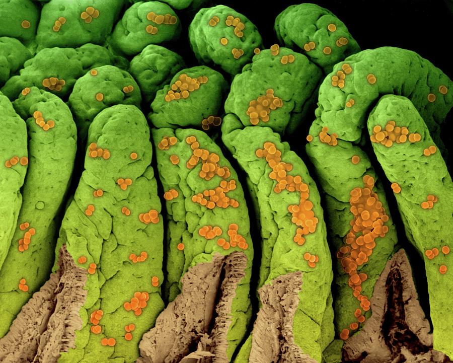 Staphylococcus Aureus On The Small Intestine Photograph By Dennis