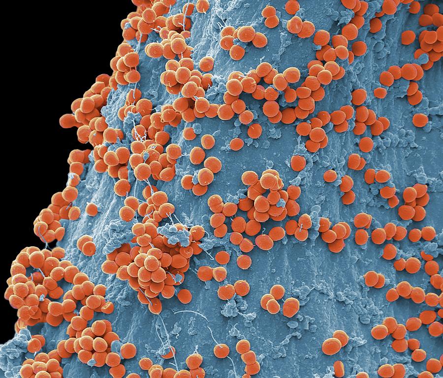 Staphylococcus Bacteria 2 By Steve Gschmeissner Science Photo Library