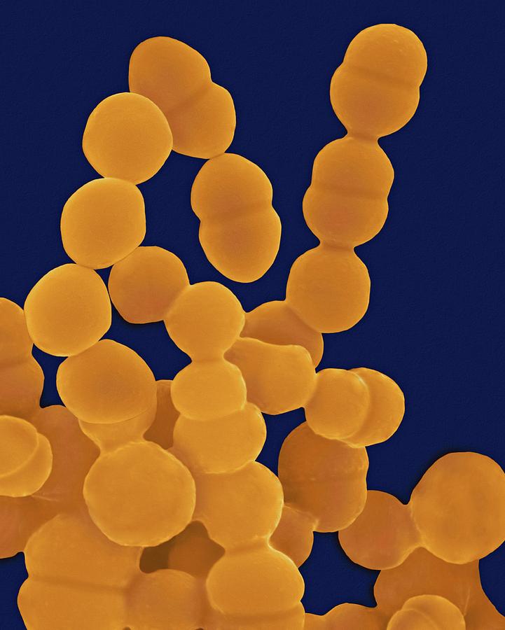 Staphylococcus Epidermidis #2 Photograph by Dennis Kunkel Microscopy/science Photo Library