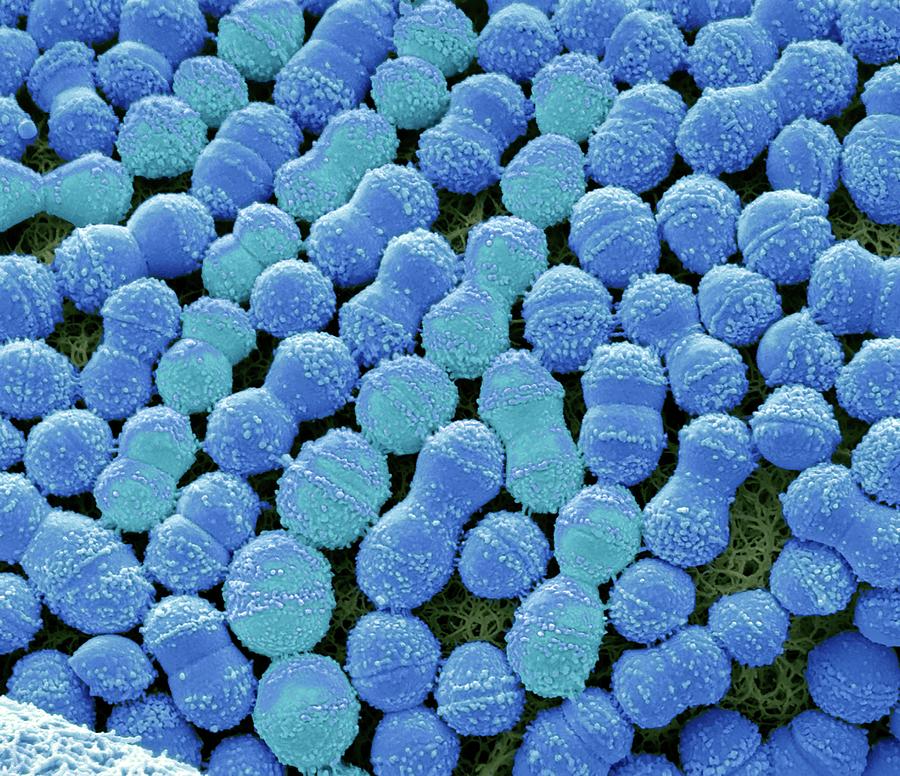 Acid Photograph - Streptococcus Mutans #2 by Steve Gschmeissner/science Photo Library