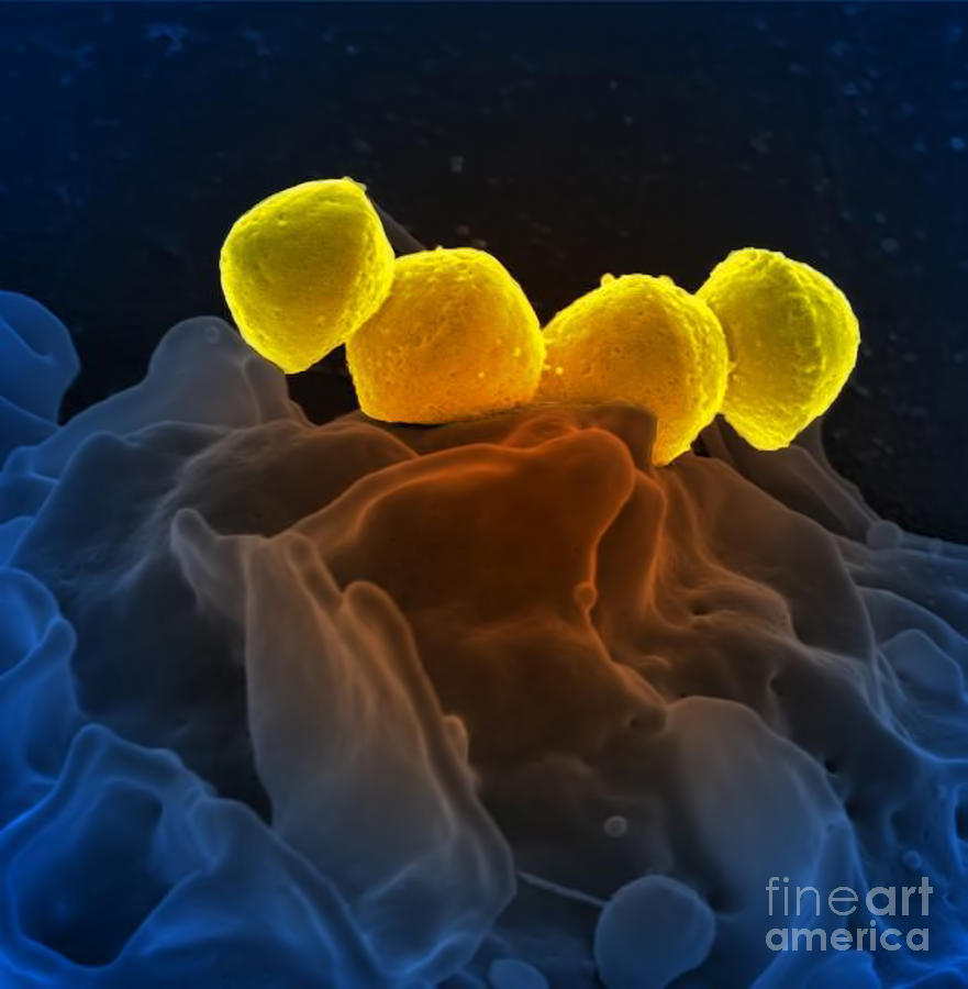 Streptococcus Pyogenes Bacteria Sem Photograph by Science Source
