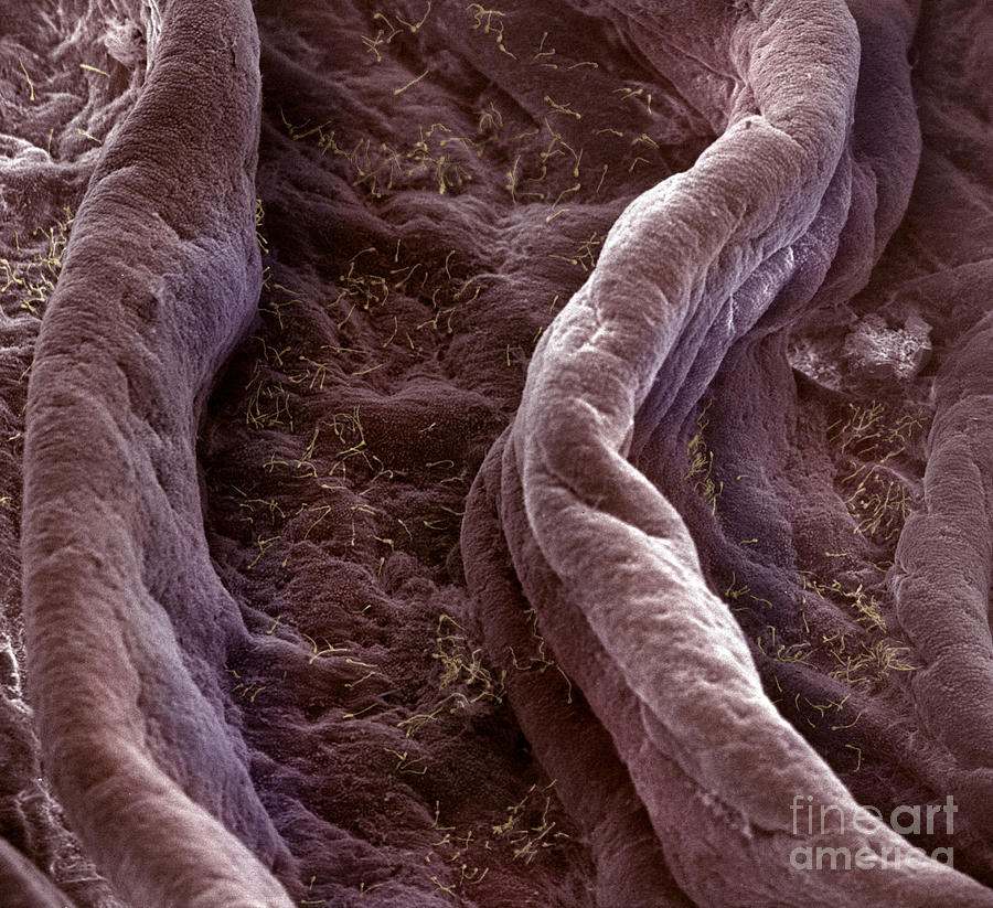 Surface Of Human Vagina #2 Photograph by David M. Phillips
