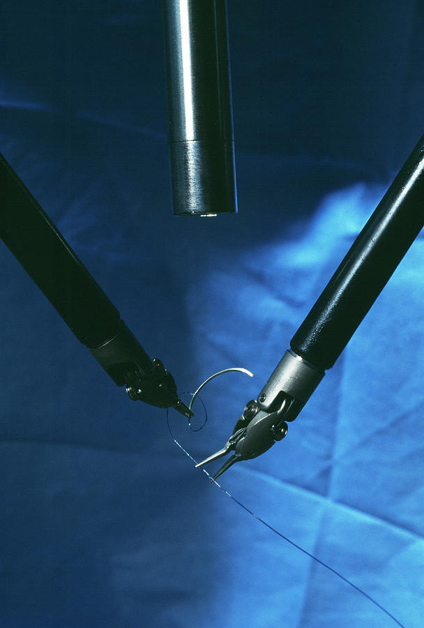 Surgical Robot #2 Photograph by Pascal Goetgheluck/science Photo Library