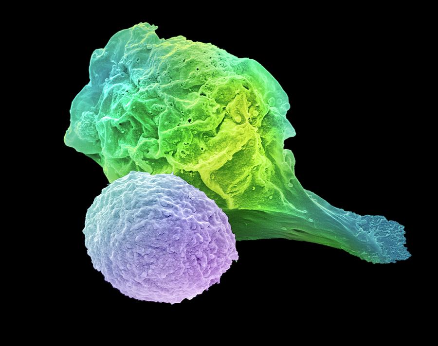 T Lymphocyte And Cancer Cell #2 Photograph by Steve Gschmeissner