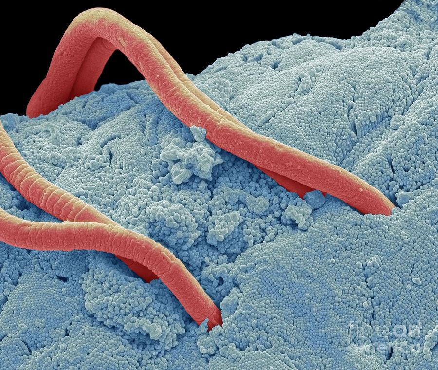 Threadworms In The Gut, Sem 2 Photograph by David Mccarthy Fine Art