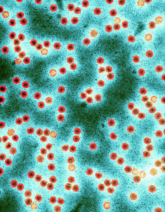Tobacco Necrosis Virus #2 Photograph by Centre For Bioimaging, Rothamsted Research/science Photo Library