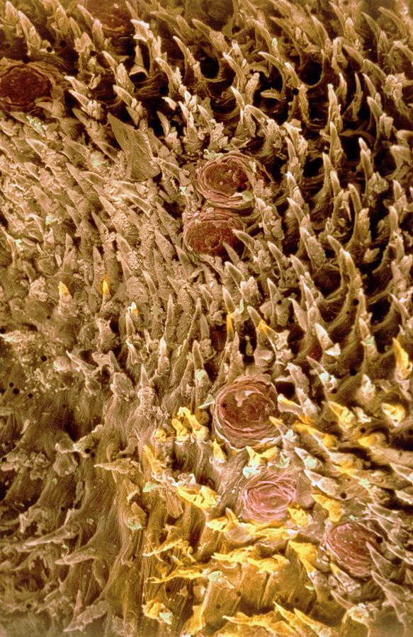 Tongue Surface Photograph by Cnri/science Photo Library - Pixels