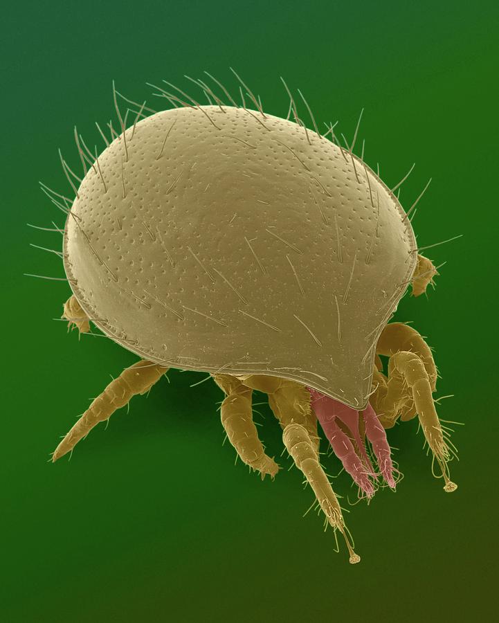 Tortoise Mite (family Uropodidae) Photograph By Dennis Kunkel 