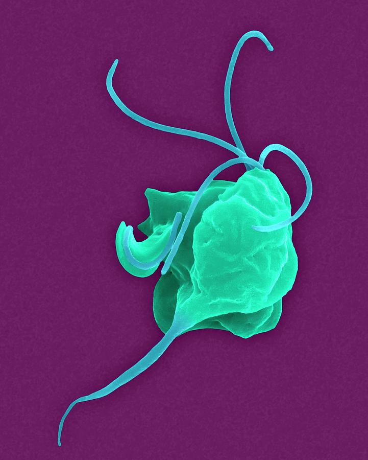 Protozoan Photograph - Trichomonas Vaginalis Parasitic Protozoan #2 by Dennis Kunkel Microscopy/science Photo Library