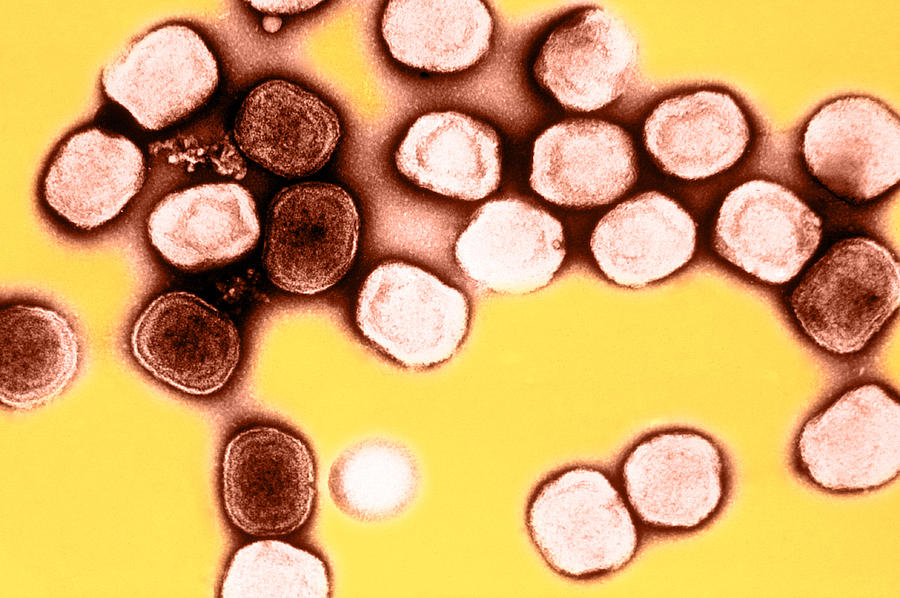 Vaccinia Virus, Eradicated Smallpox, Tem #2 Photograph by Science Source