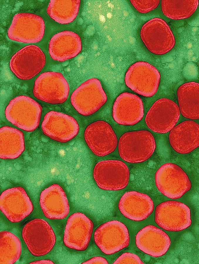 Variola Virus #2 Photograph by Dennis Kunkel Microscopy/science Photo Library