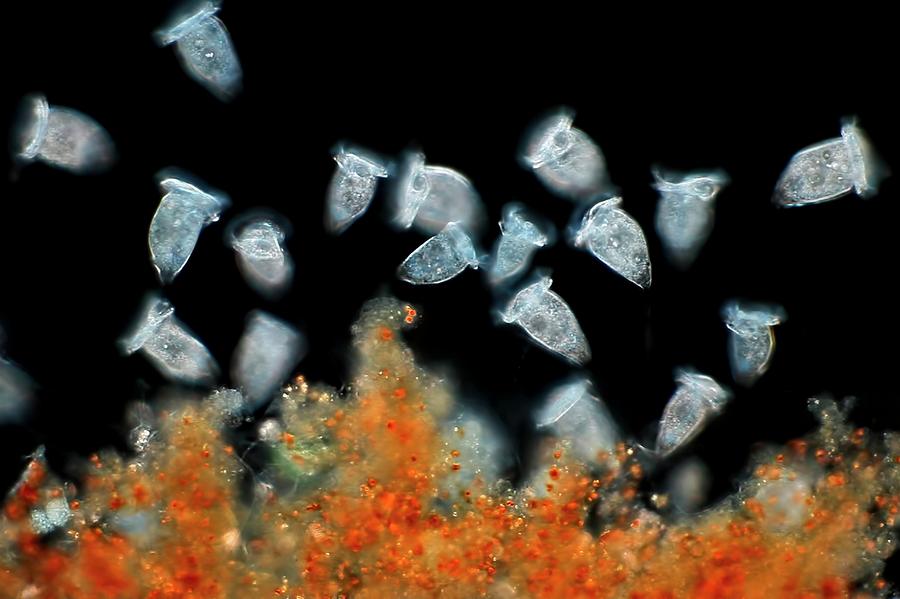 Nature Photograph - Vorticella Protozoa #2 by Frank Fox