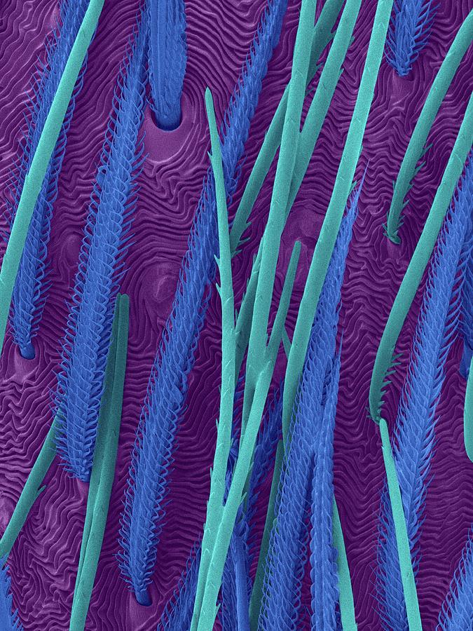 Wolf Spider Abdomen Hairs #2 Photograph by Dennis Kunkel Microscopy/science Photo Library