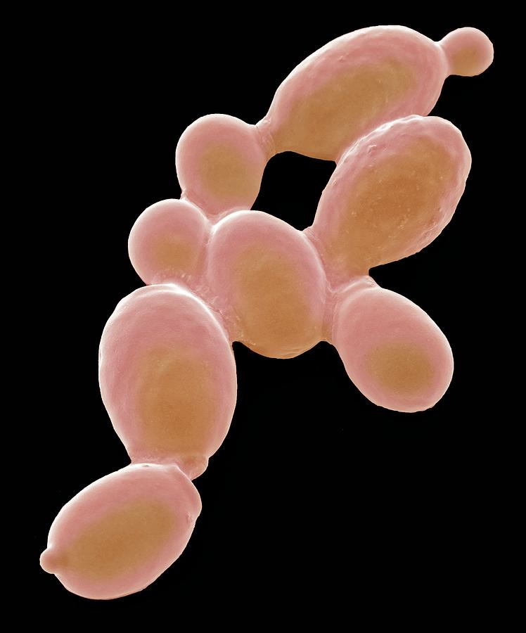 Yeast Cells Photograph By Steve Gschmeissnerscience Photo Library Fine Art America 1546