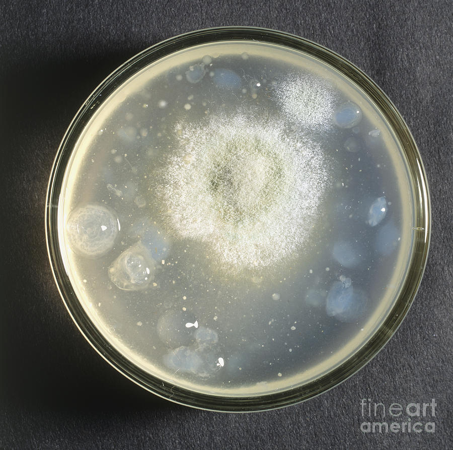 Yeast Culture In Petri Dish #2 Photograph by Frank Greenaway / Dorling Kindersley