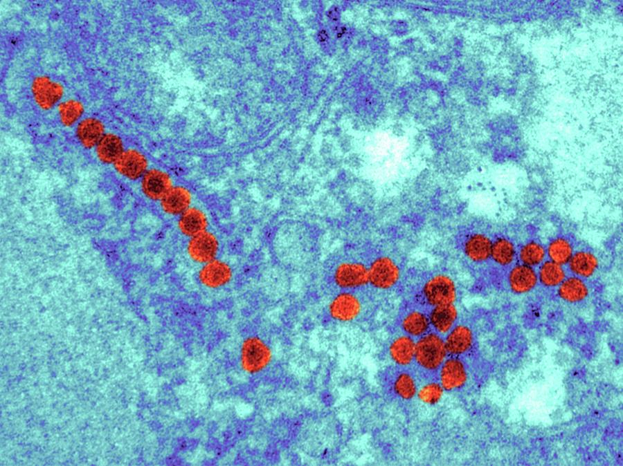 Zika Virus Particles Photograph by Dr Klaus Boller/science Photo Library