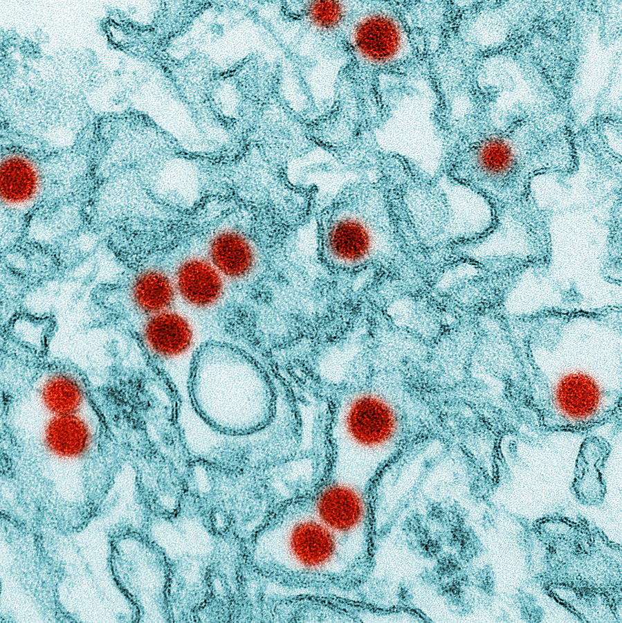 Zika Virus, Tem #2 Photograph by Science Source