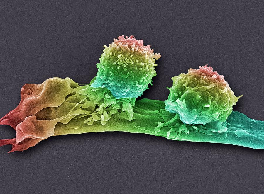 Cancer Cell And T Lymphocytes #20 Photograph by Steve Gschmeissner