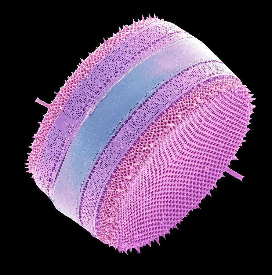 Diatom #20 Photograph by Steve Gschmeissner/science Photo Library