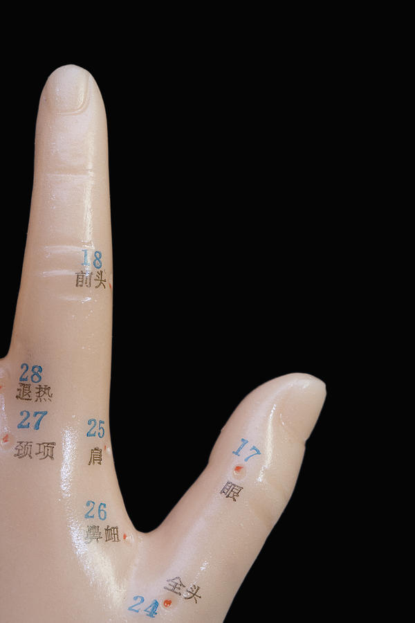 Acupuncture Points #21 Photograph by Science Stock Photography
