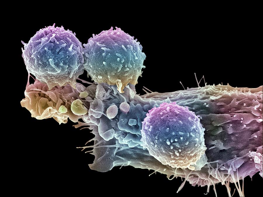 Cancer Cell And T Lymphocytes #21 Photograph by Steve Gschmeissner