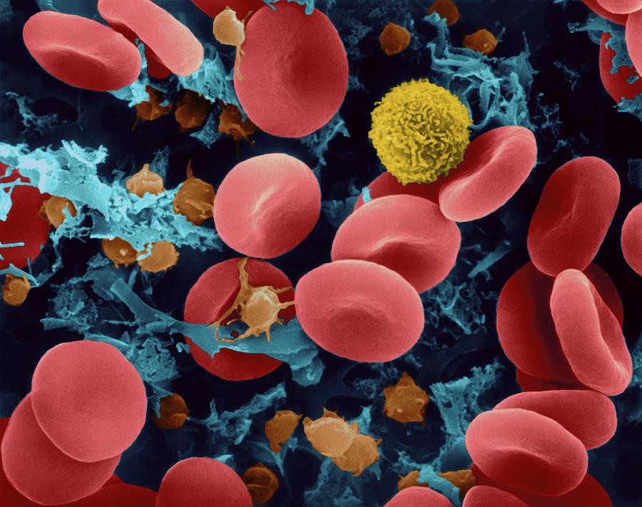 Red Blood Cells #21 Photograph by Dennis Kunkel Microscopy/science Photo Library