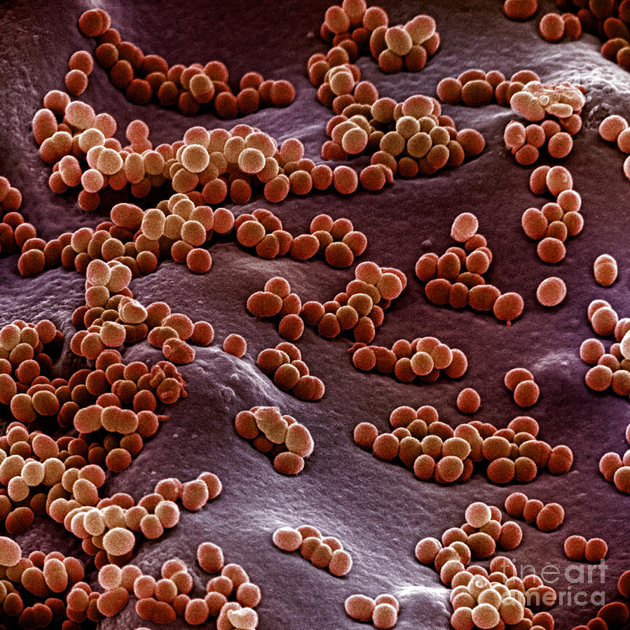 Bacteria Photograph - Staphylococcus Aureus #21 by David M. Phillips
