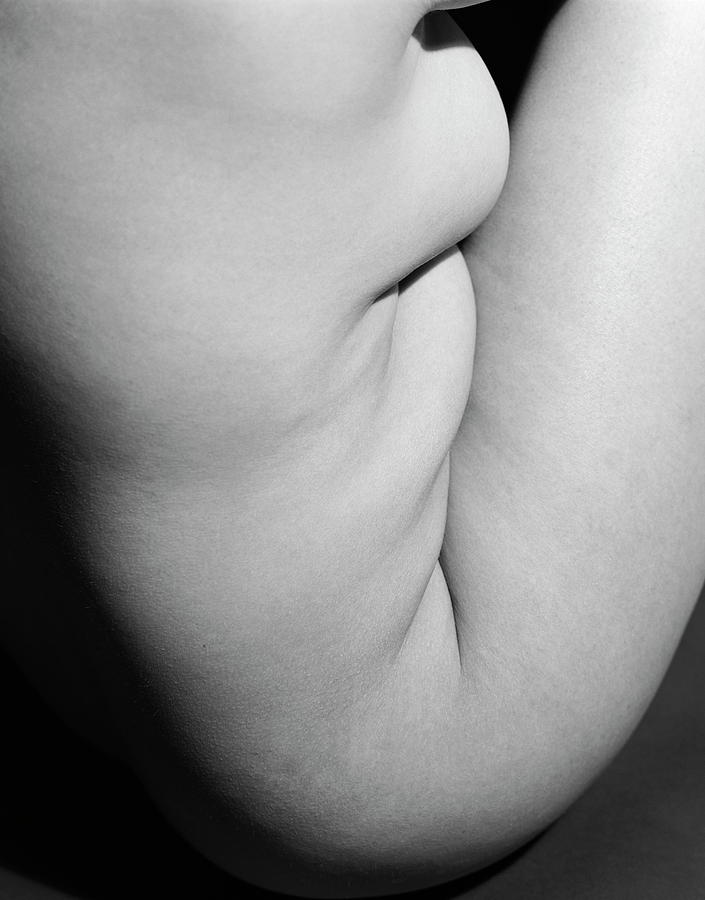 Womans Body #21 Photograph by Kate Jacobs/science Photo Library