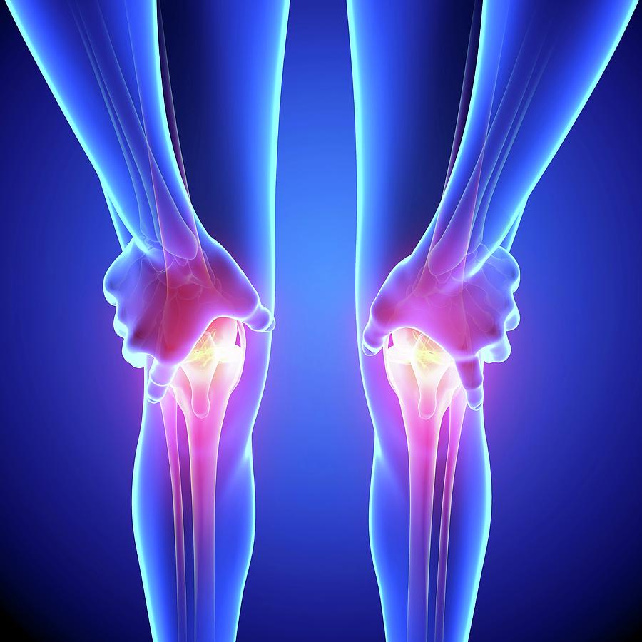 Knee Pain #22 by Pixologicstudio/science Photo Library