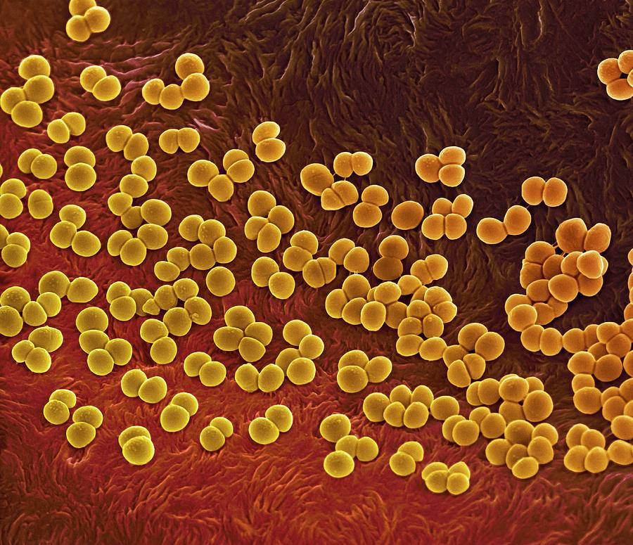 Mrsa Bacteria Photograph By Science Photo Library 3504