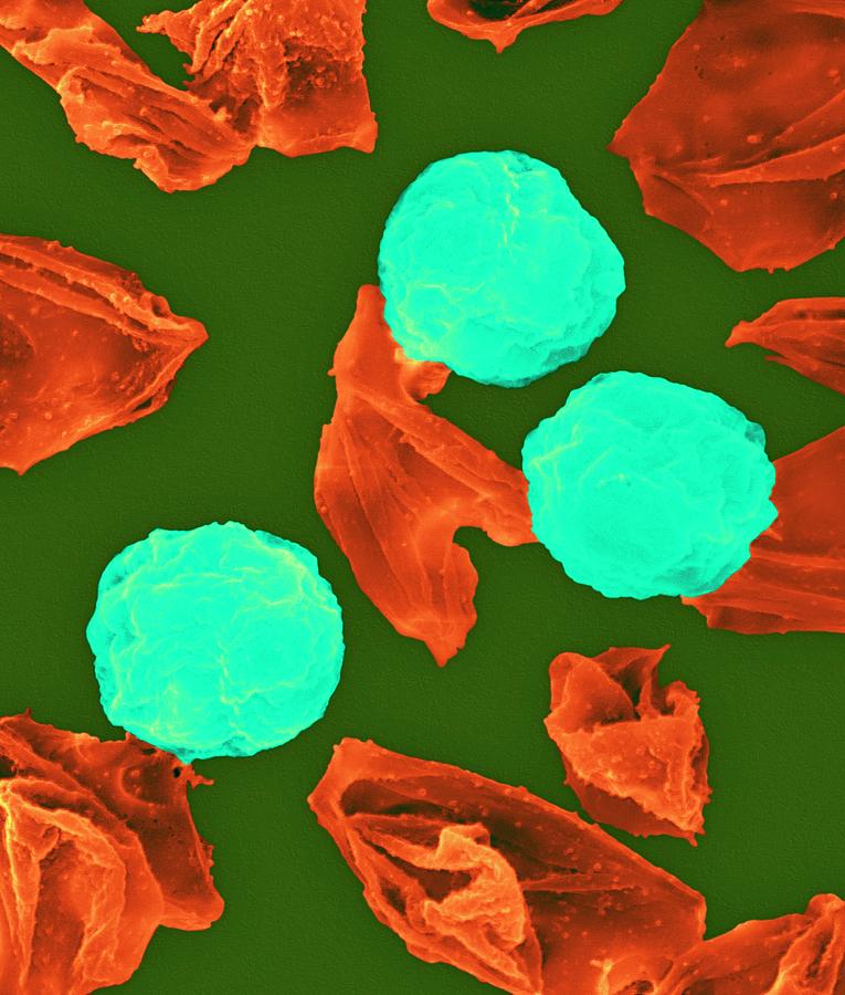 Plasmodium Falciparum #22 Photograph by Dennis Kunkel Microscopy/science Photo Library
