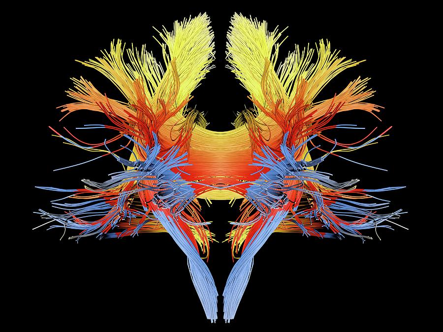 White Matter Fibres Of The Human Brain Photograph by Alfred Pasieka